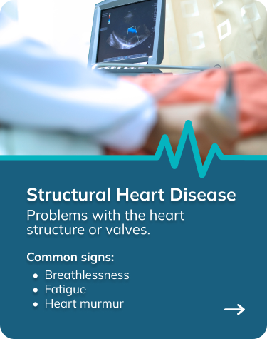 Structural heart disease signs.png