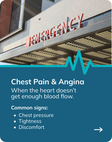 Chest pain signs.png